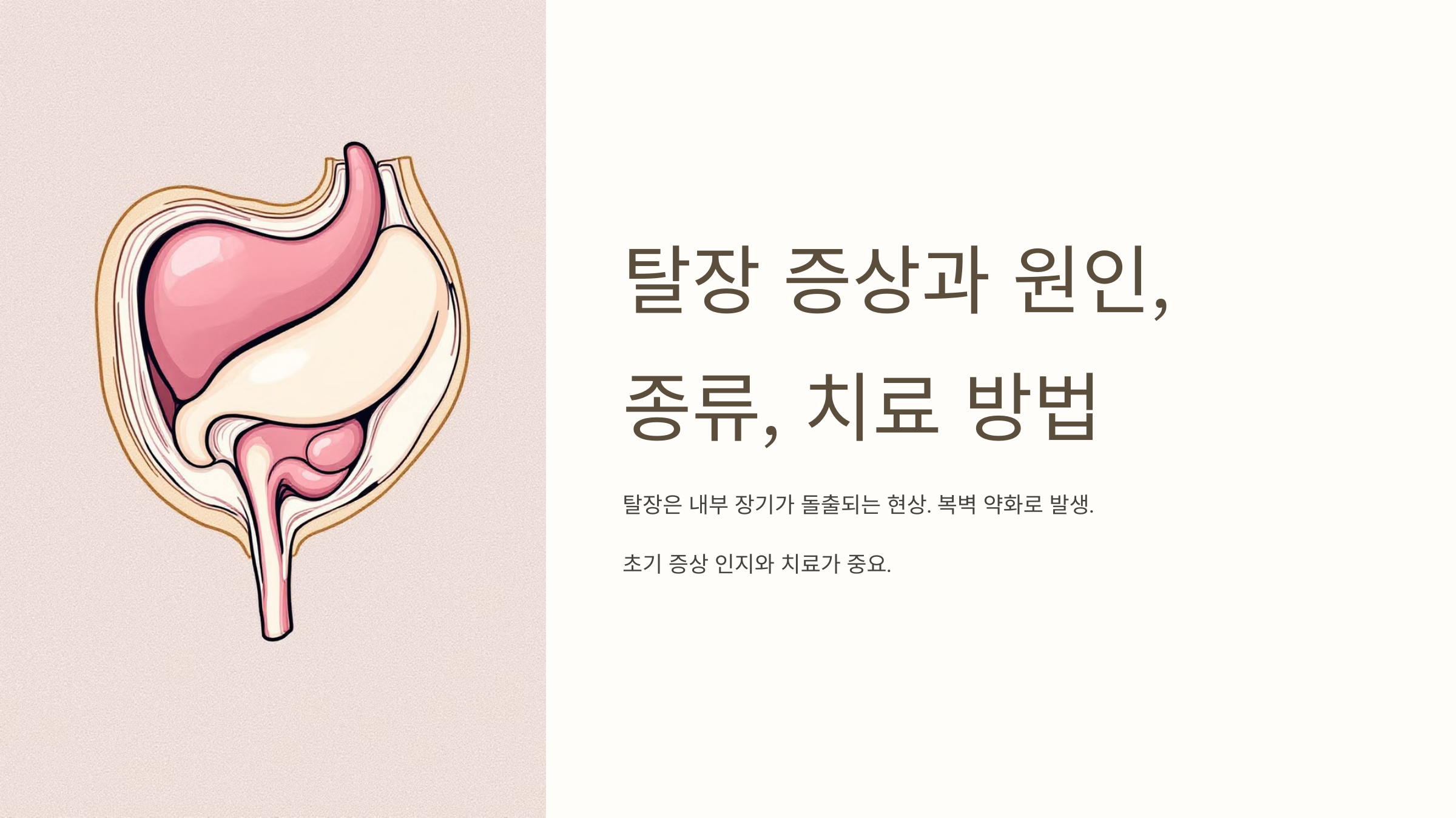 탈장과 관련된 사진입니다.