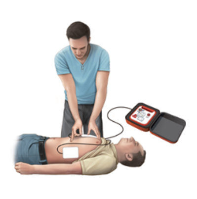 심장충격기사용방법