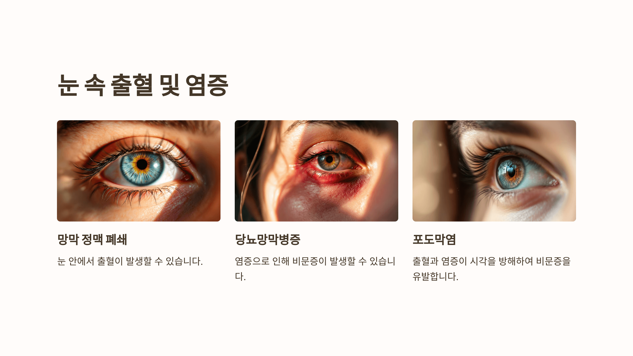 비문증과 관련된 사진입니다.