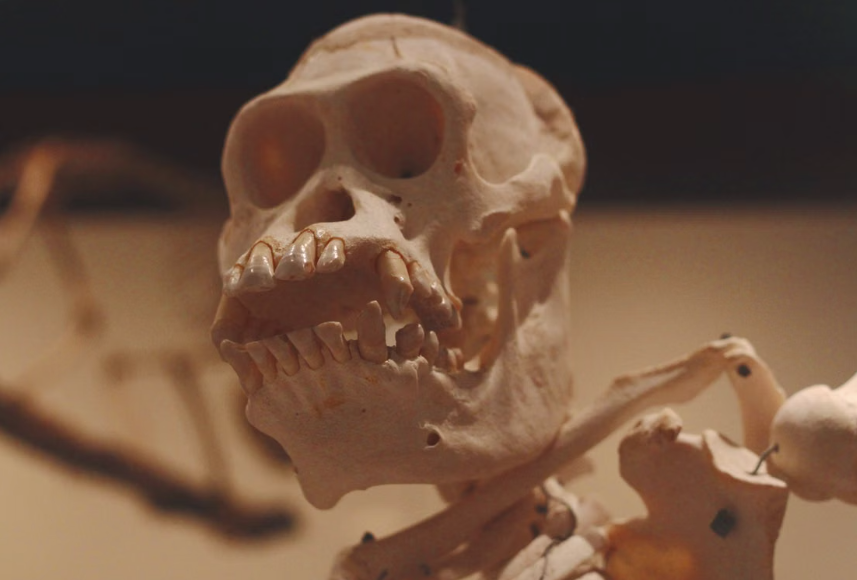 파라카스의 길쭉한 두개골(Paracas Elongated Skulls), 고대 페루 사람들의 머리는 왜 비정상적으로 길어졌을까?
