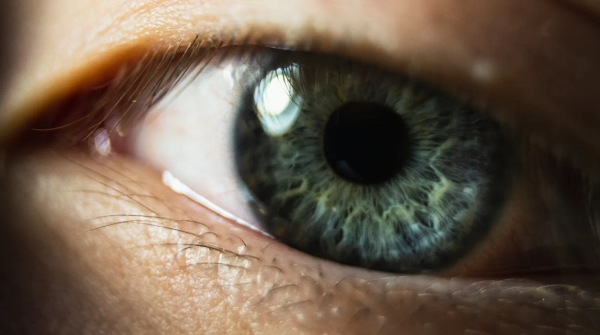 스타가르트병 관련 사진