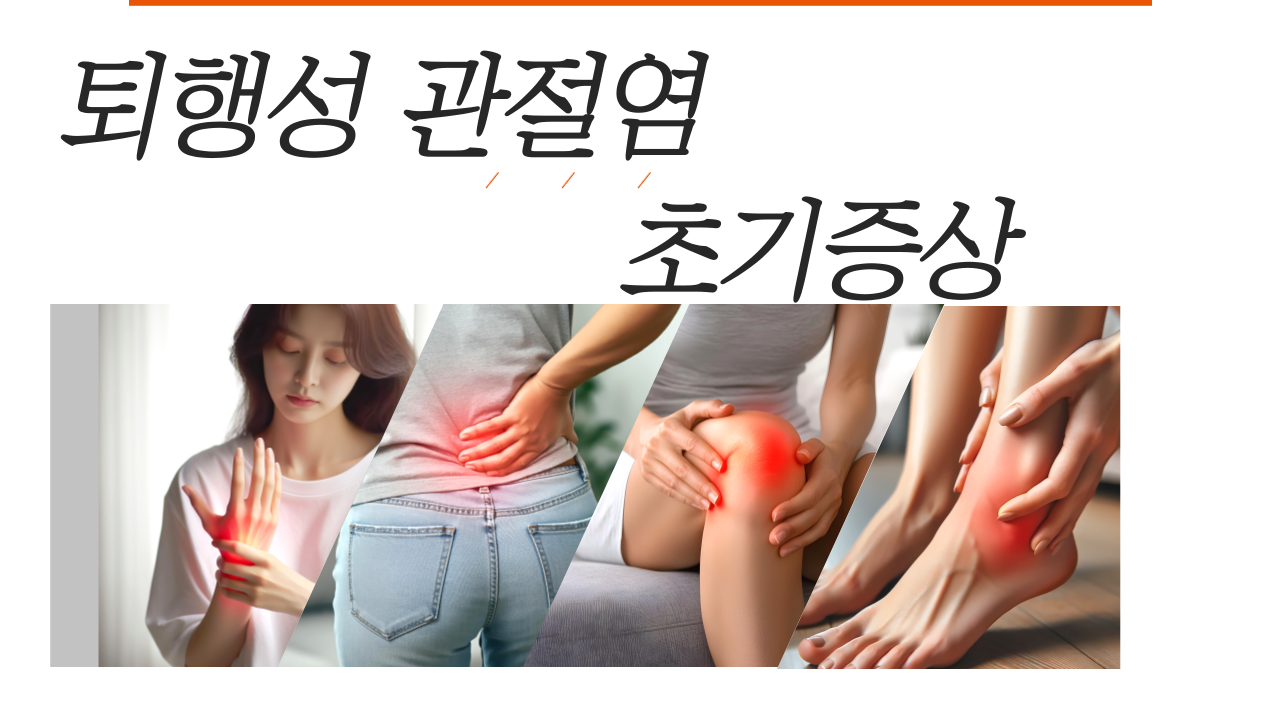퇴행성 관절염 초기 증상, 그냥 넘기면 치료 시기 놓칩니다