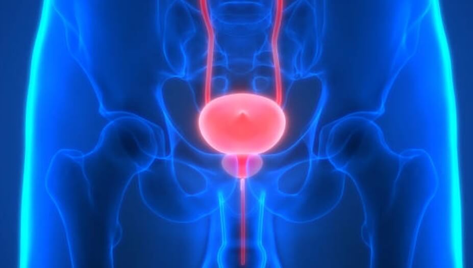 전립선비대증약물치료