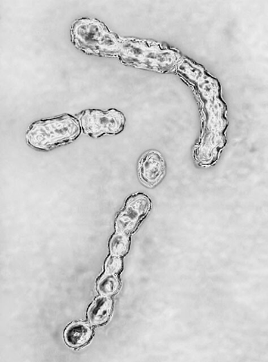 일본 전염병 STSS