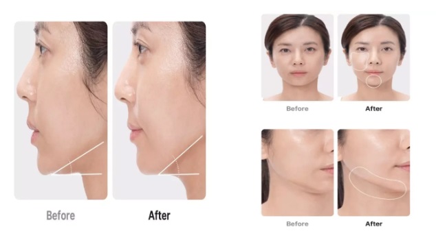 완벽을-넘어선-피부를-위해-메디큐브-에이지알-부스터-프로-리뷰