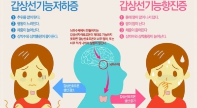 갑상선 이미지
