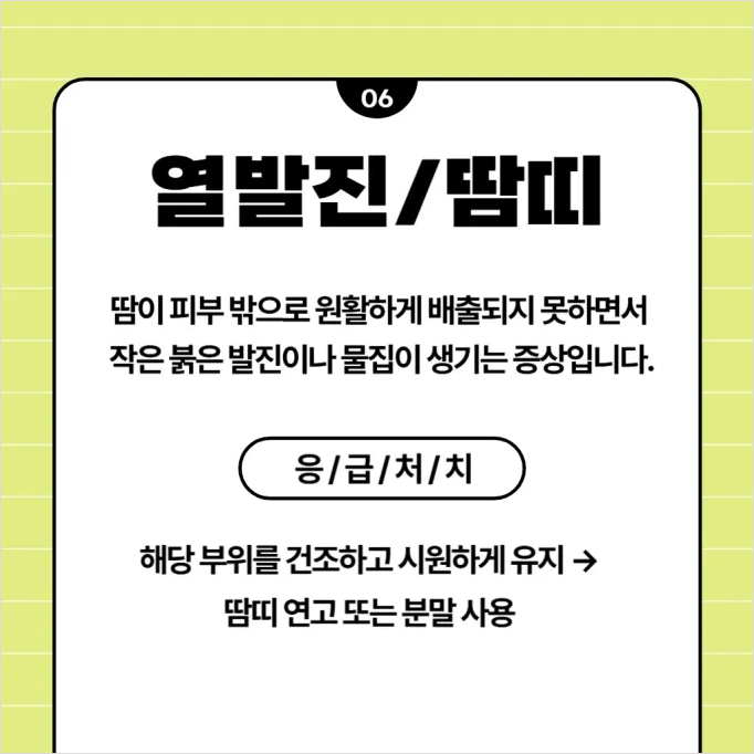 온열질환 증상