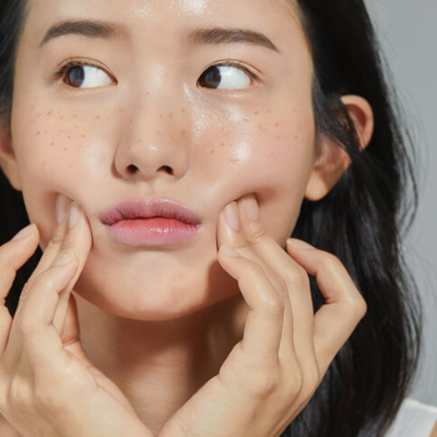 검버섯이 핀 얼굴