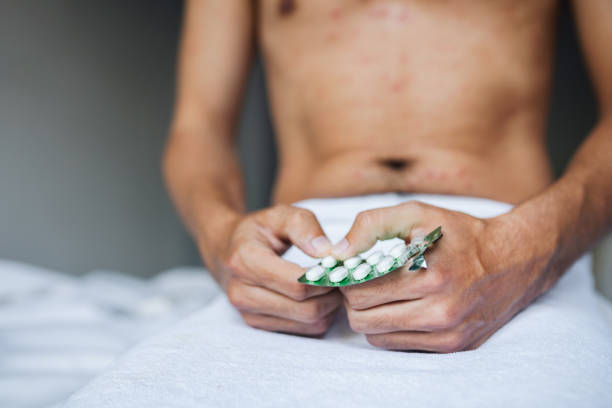 헤르페스 2형 단순 포진 바이러스 증상