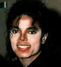 마이클잭스 백반증