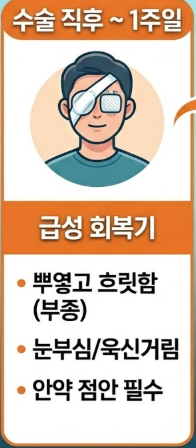 백내장 수술후 시력회복 기간