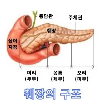 췌장암 초기 증상 췌장암 등통증 위치 검사_24