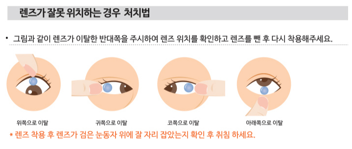 렌즈위치
