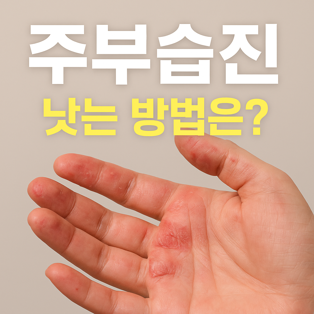 주부습진