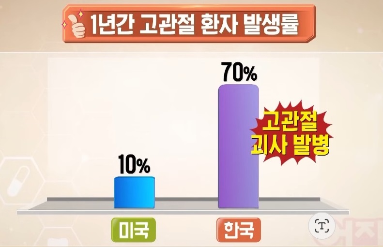 고관절환자-발생률