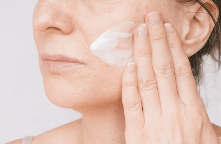 피부 재생크림과 수분크림 혼동, 여드름 흉터에는 뭐가 좋을까?