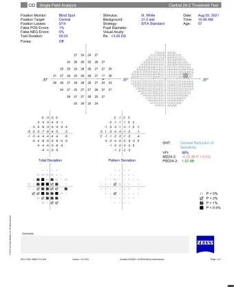 녹내장 진단 검사 비용 안압 검사주기 관리법_4