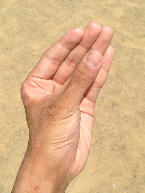 손톱 세로줄 원인