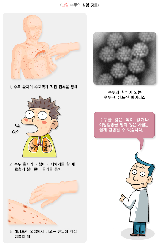 수두의 감염경로