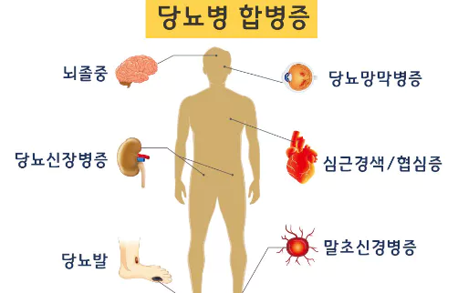 당뇨병-합병증