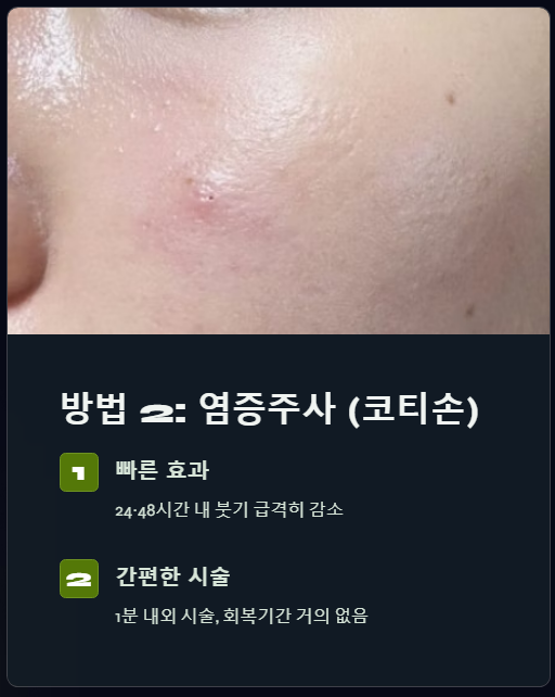염증주사 코티손