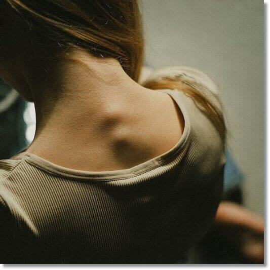 목디스크 초기증상, 원인 및 진단과 치료