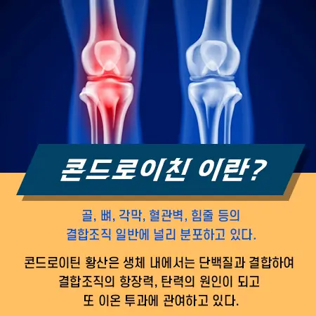 콘드로이친