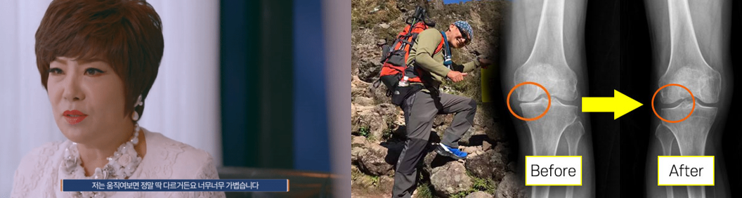 관절보궁-김연자-가격-효능-부작용-섭취방법