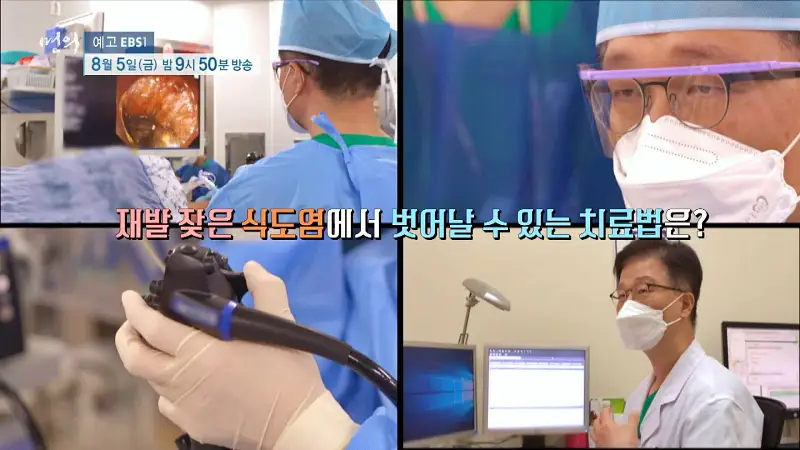 명의 타는 듯한 가슴 통증 식도가 보내는 SOS 역류성 식도염, 식도암 예방 방법 병원 추천 소개