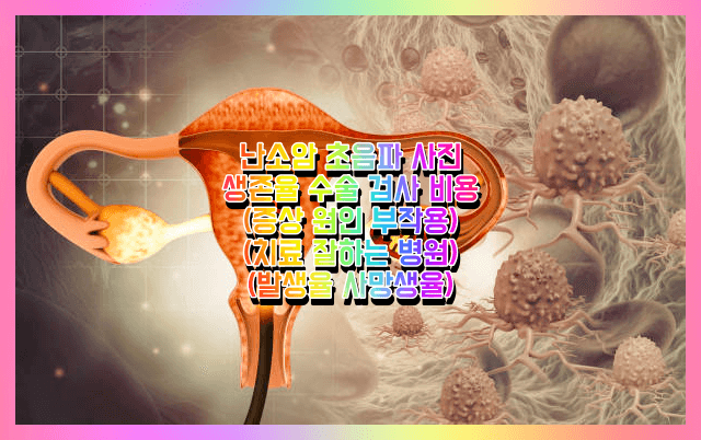 난소암 요약