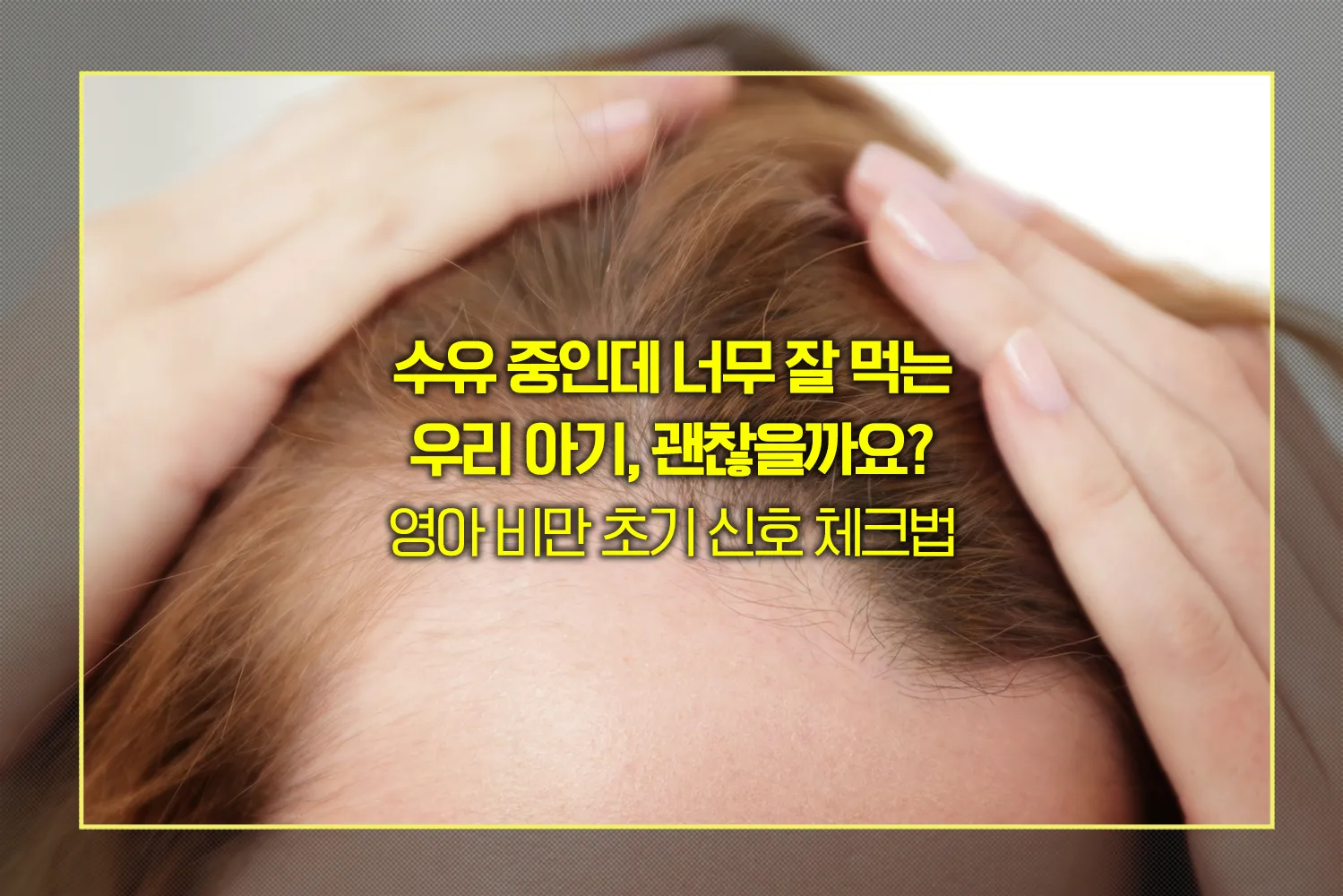 출산후-산욕기-탈모-언제끝나나요