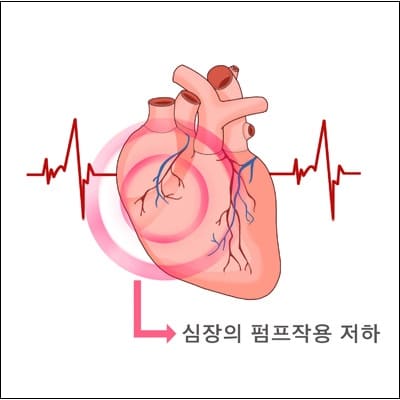 "수분 유지하면 심부전 위험 줄일 수 있다" NHBI Staying hydrated may reduce the risk of heart failure