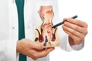 치질