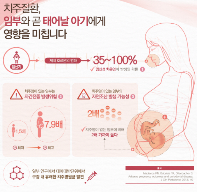 임산부 치아 관리