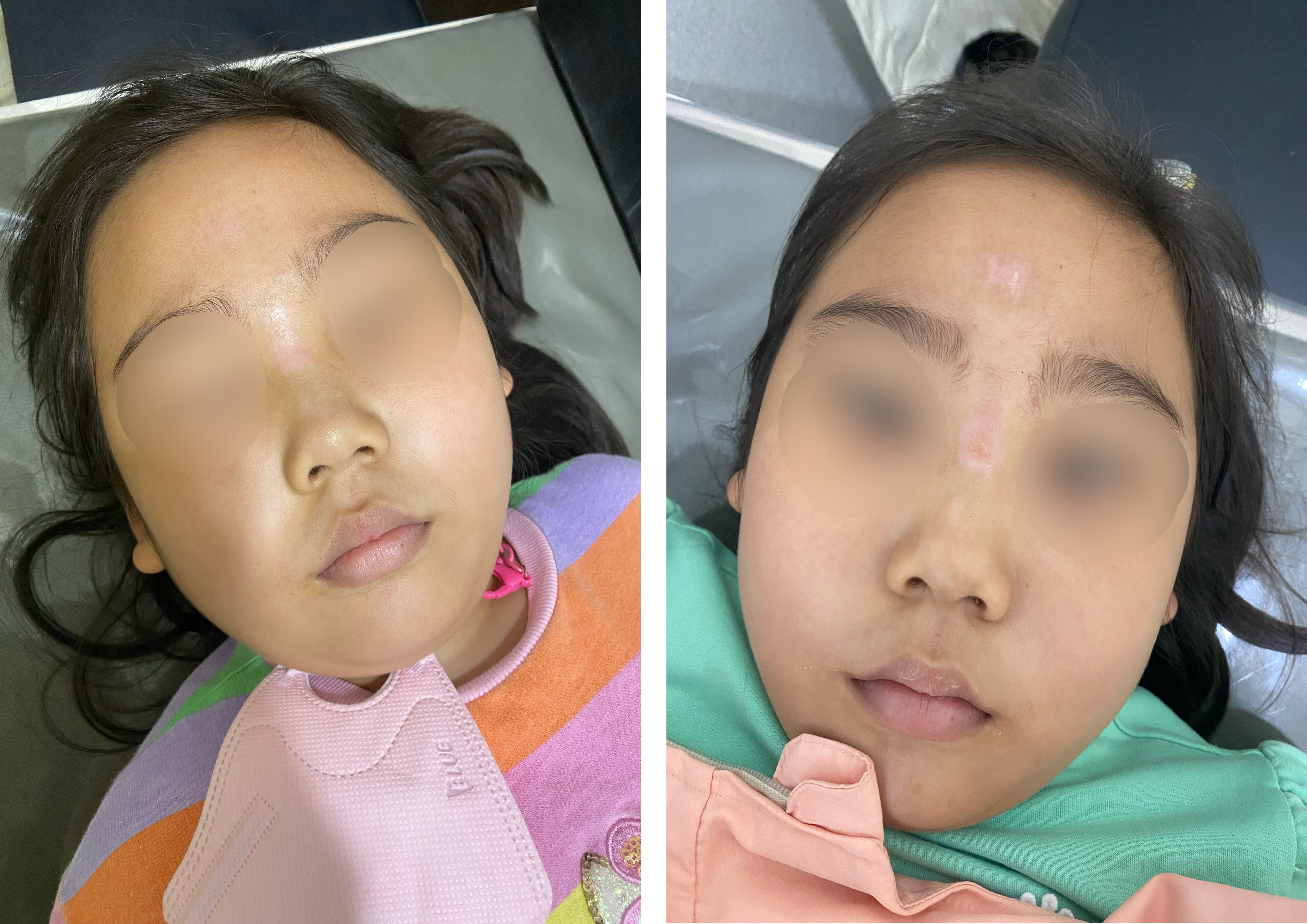 사고발생 후 10일 정도 지난 상태