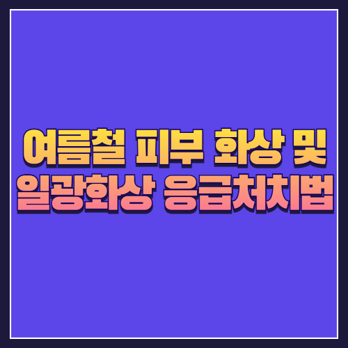 여름철 피부 화상 및 일광화상 응급처치법