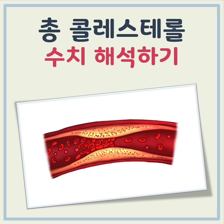 총 콜레스테롤 수치 대표 이미지