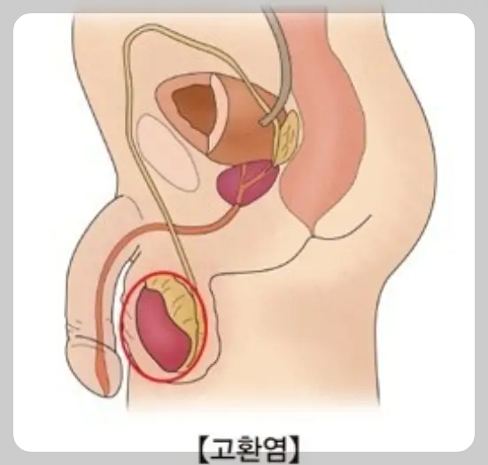 고환염