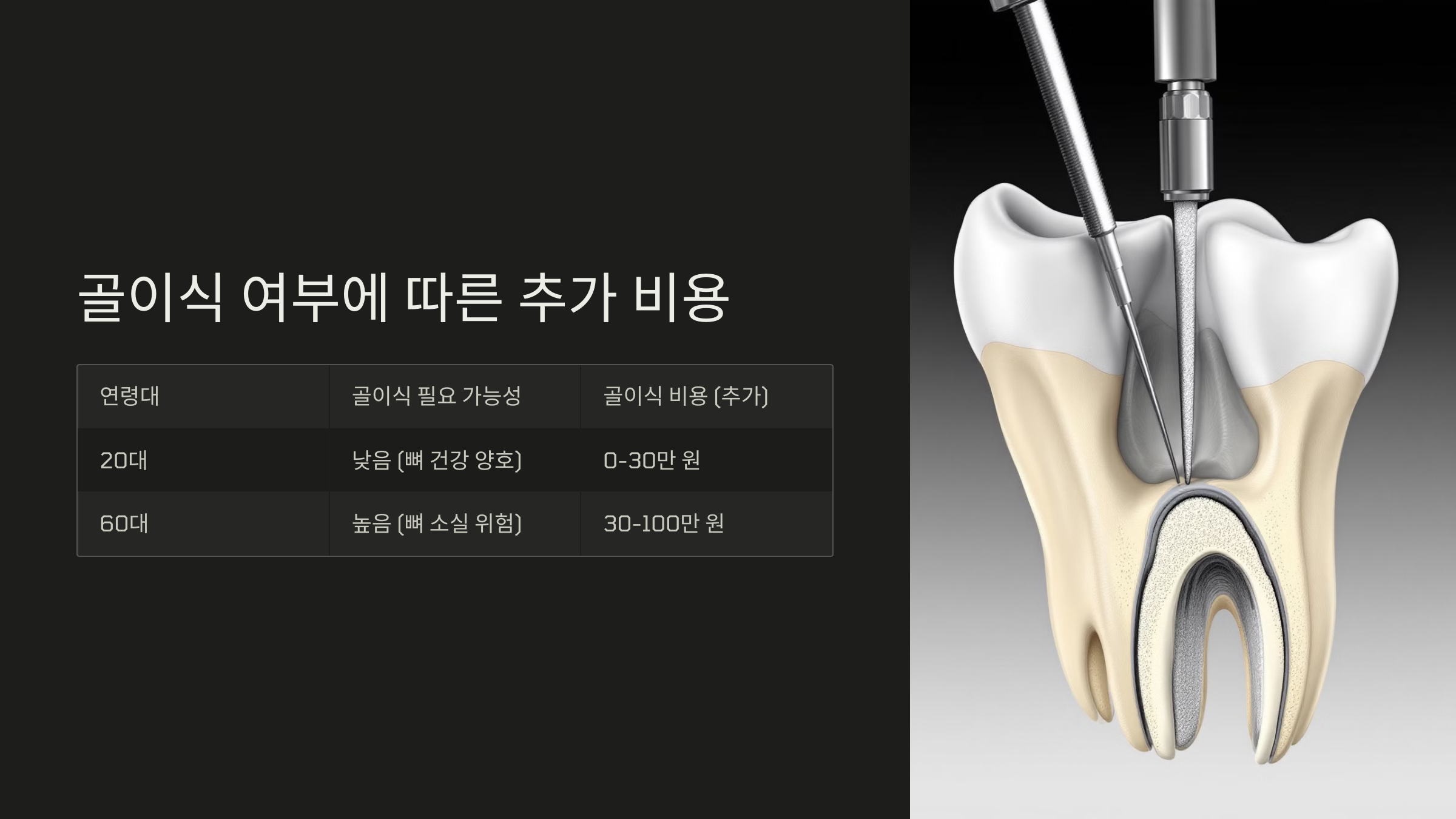 골이식 여부에 따른 추가 비용