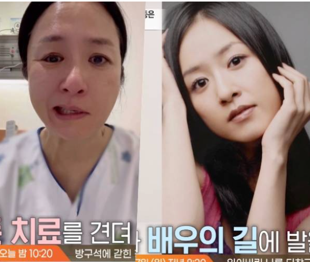 지종은 배우