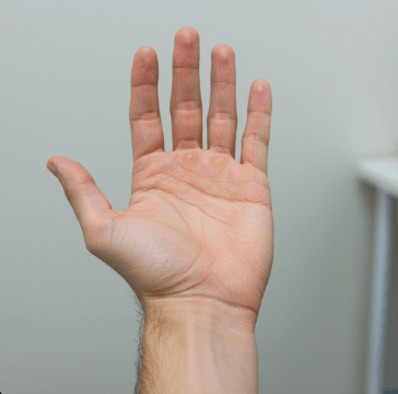 손목터널증후군 증상 및 치료법2