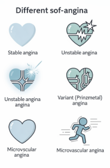 협심증 초기증상
