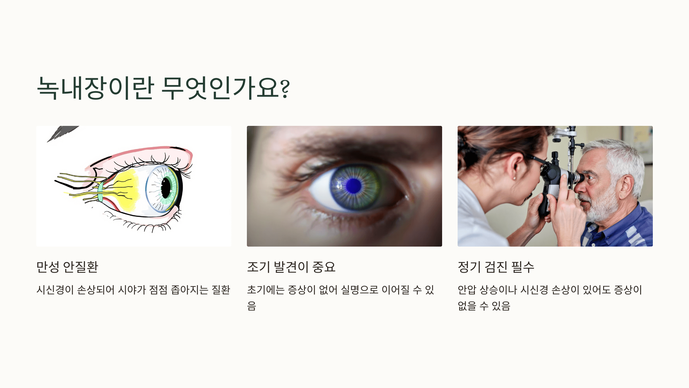 녹내장과 관련된 사진입니다.