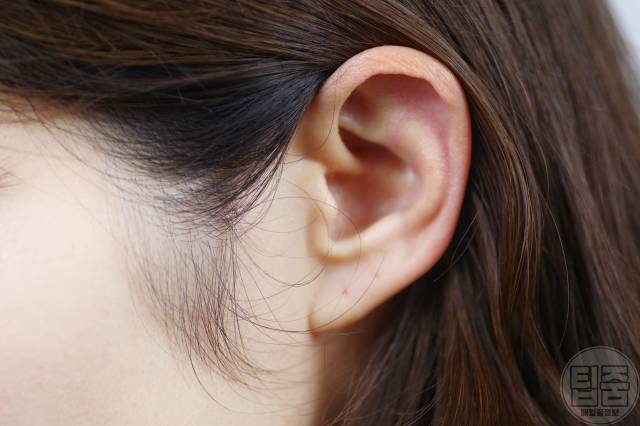 귓볼주름 심장마비 전조증상