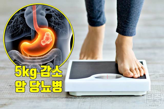 40대 50대 이유없이 살빠짐 위암 폐암 식도암 췌장암