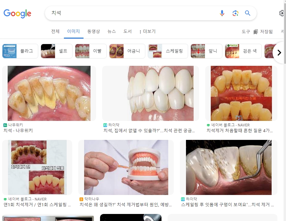 건강하고 밝은 미소를 짓고 있는 여성의 모습