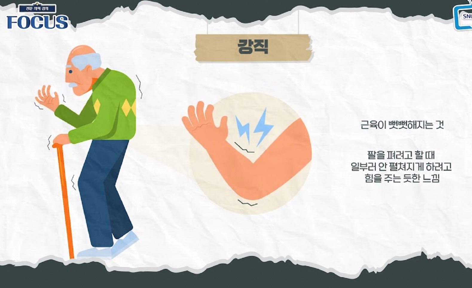 명의-파킨슨-김한준-교수-증상