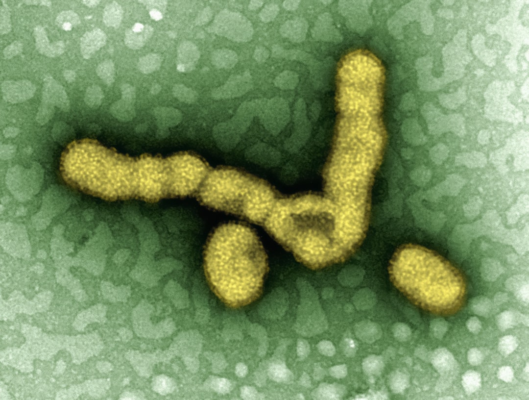 Influenza.