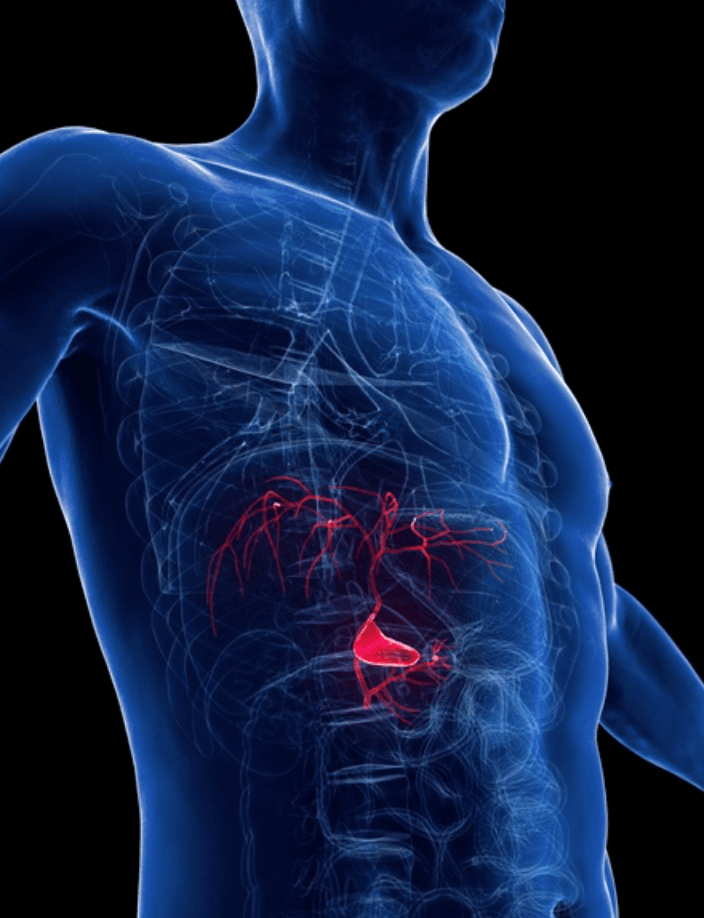 오른쪽 옆구리 통증 담낭염