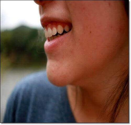 피지 낭종이 저절로 나은 여성